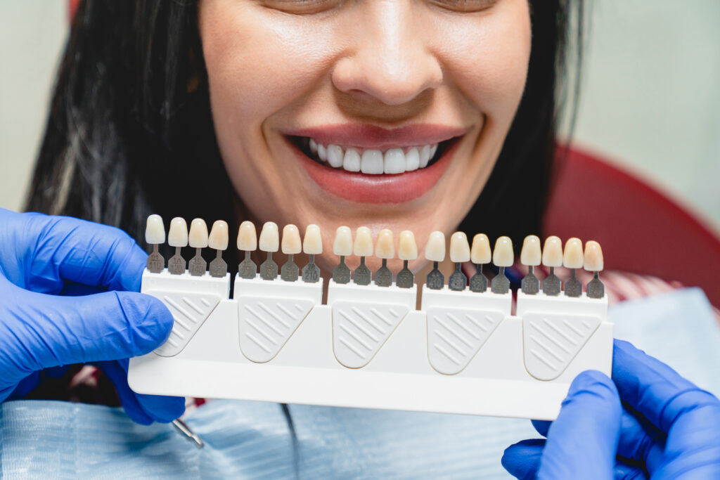 dental crown material