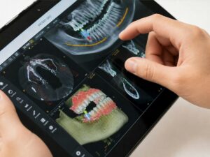 Step-by-Step Walkthrough for Your First Dental Implant Visit